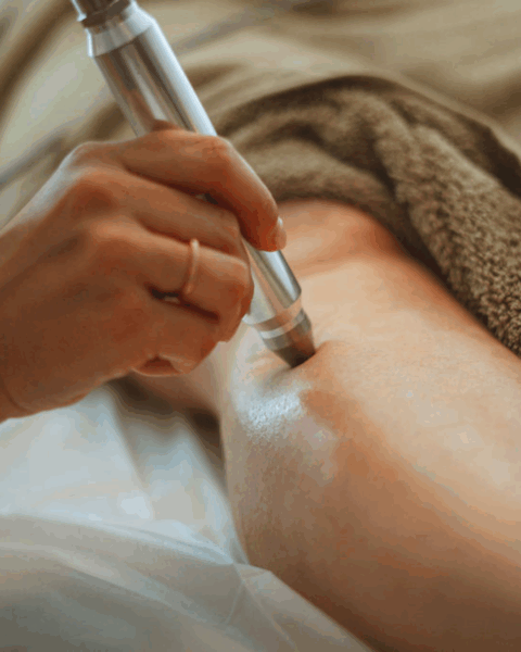 La luxopuncture : le soin doux et holistique