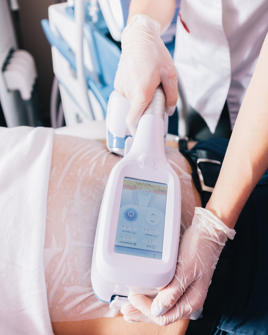Les techniques esthétiques et localisées (cryolipolyse, soins minceur)